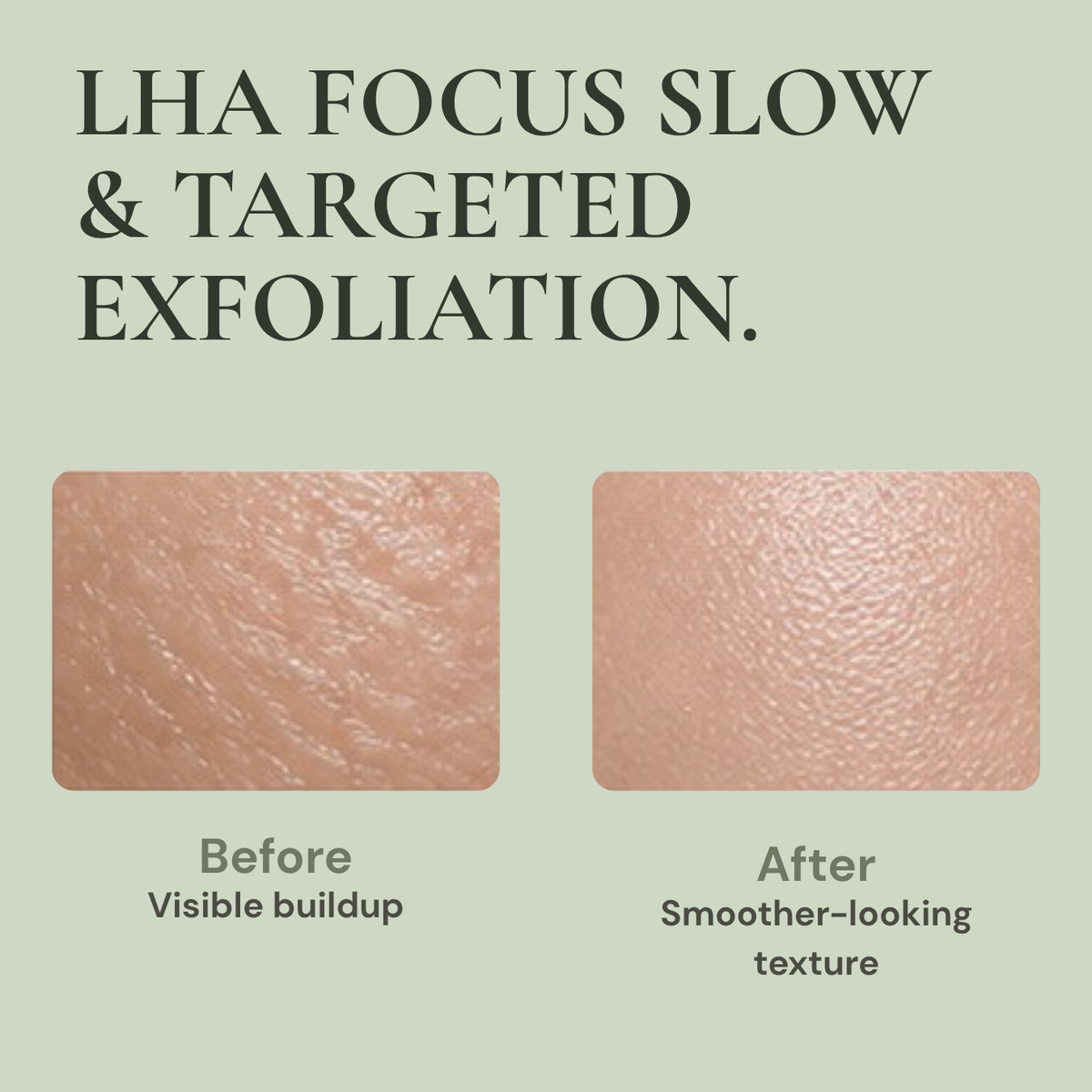 AXIS-Y LHA Peel & Fill Pore Balancing Cream | Hydrating Pore Refining Moisturizer | 80ml