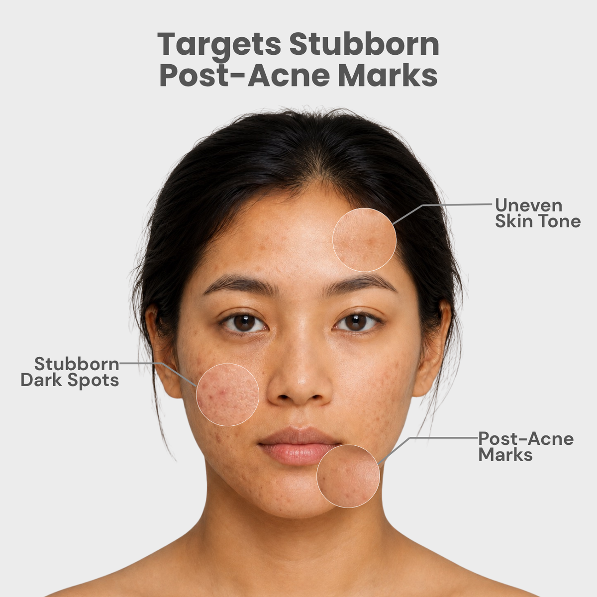 COSRX The Alpha-Arbutin 2 Discoloration Care Serum – 50ml | Brightening & Dark Spot Care Serum