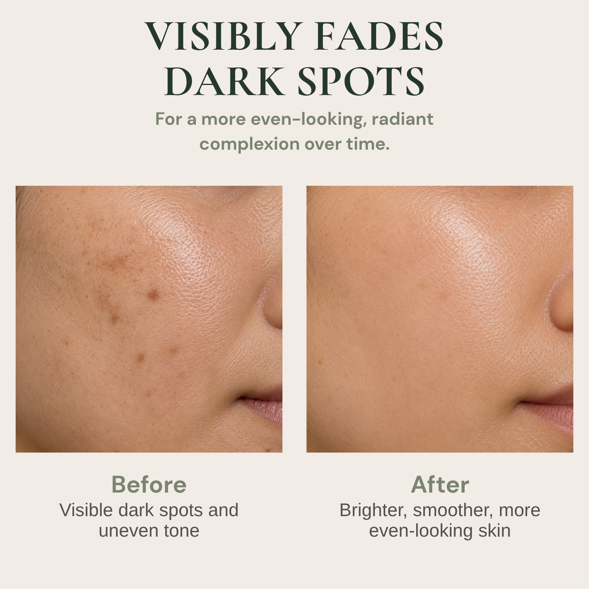 AXIS-Y Dark Spot Correcting Glow Serum | Niacinamide 5% Brightening Serum for Dark Spots & Uneven Skin Tone | 50ml