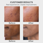 COSRX The Alpha-Arbutin 2 Discoloration Care Serum – 50ml | Brightening & Dark Spot Care Serum